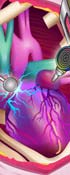 Monster High Heart Surgery