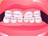 Dentist Games