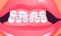 Transformação dos Dentes da Menina