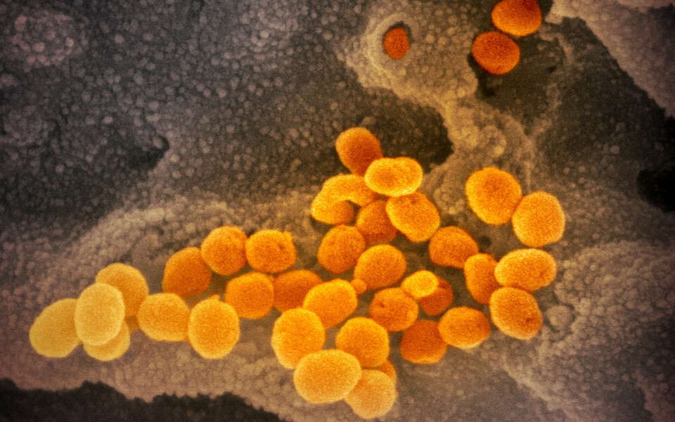Coronavirus infecting SARS-CoV-2 cell culture.