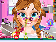 Anna Doctor Nose Ceck!