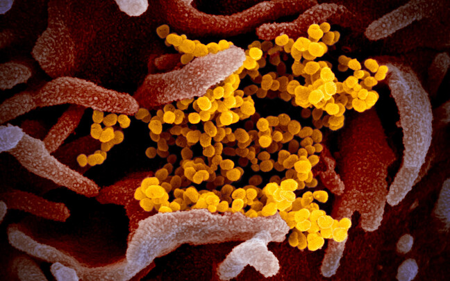 Koroonaviirus SARS-CoV-2 rakukultuuri taustal.